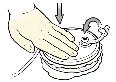 Primer plano de una mano enguantada presionando el drenaje Hemovac. La flecha indica que el tapón se está cerrando.