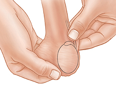 Primer plano de manos que revisan los conductos deferentes durante un autoexamen testicular.